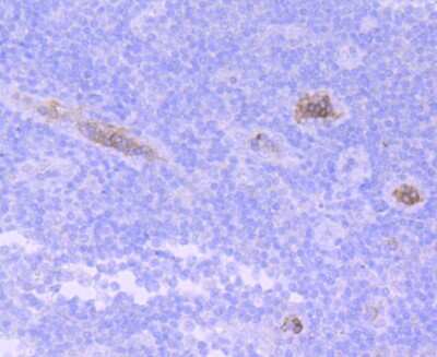 Immunohistochemistry-Paraffin: HBG1/2 Antibody (JM84-10) [NBP2-66885] - Analysis of paraffin-embedded human tonsil tissue using anti-HBG1/2 antibody. Counter stained with hematoxylin.