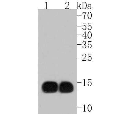 Western Blot HBG1/2 Antibody (JM84-10)