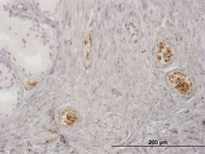 Immunohistochemistry-Paraffin: Hemoglobin zeta Antibody (1G10) [H00003050-M03] - Analysis of monoclonal antibody to HBZ on formalin-fixed paraffin-embedded human prostate. Antibody concentration 3 ug/ml