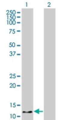 Western Blot: Hemoglobin zeta Antibody (1G10) [H00003050-M03] - Analysis of HBZ expression in transfected 293T cell line by HBZ monoclonal antibody (M03), clone 1G10. Lane 1: HBZ transfected lysatE (15.6 KDa). Lane 2: Non-transfected lysate.