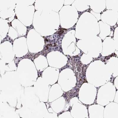 Immunohistochemistry: Hemoglobin zeta Antibody [NBP2-68924] - Immunohistochemical staining of human bone marrow shows strong cytoplasmic positivity in hematopoietic cells.