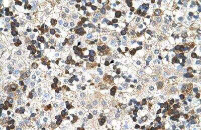 Immunohistochemistry-Paraffin: Hemoglobin zeta Antibody [NBP1-56354] - Human Liver Tissue, antibody concentration 4-8ug/ml. Cells with positive label: Hepatocytes (indicated with arrows) 400X magnification.