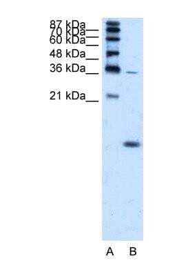 Western Blot: Hemoglobin zeta Antibody [NBP1-56354] - K562 cell lysate, Antibody Titration: 1.25ug/ml