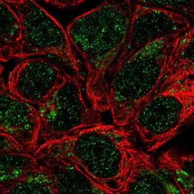 Immunocytochemistry/Immunofluorescence: Heparan Sulfate 2-O-Sulfotransferase 1/HS2ST1 Antibody [NBP2-57855] - Staining of human cell line RT4 shows localization to nucleus & mitochondria.