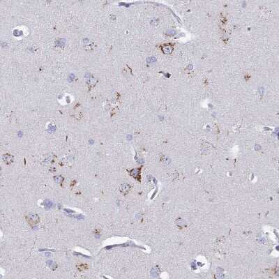 Immunohistochemistry-Paraffin: Heparan Sulfate 2-O-Sulfotransferase 1/HS2ST1 Antibody [NBP1-91982] - Staining of human cerebral cortex shows moderate granular cytoplasmic positivity in neurons.