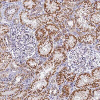 Immunohistochemistry-Paraffin: Heparan Sulfate 2-O-Sulfotransferase 1/HS2ST1 Antibody [NBP1-91982] - Staining of human kidney shows moderate granular cytoplasmic positivity in cells in tubules.