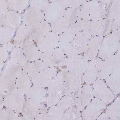 Immunohistochemistry-Paraffin: Heparan Sulfate 2-O-Sulfotransferase 1/HS2ST1 Antibody [NBP1-91982] - Staining of human skeletal muscle shows no positivity in myocytes as expected.