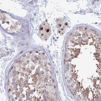 Immunohistochemistry-Paraffin Heparan Sulfate 2-O-Sulfotransferase 1/HS2ST1 Antibody