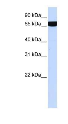 Western Blot: Heparan Sulfate 2-O-Sulfotransferase 1/HS2ST1 Antibody [NBP1-79294] - Titration: 0.2-1 ug/ml, Positive Control: 721_B cell lysate.