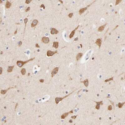 Immunohistochemistry-Paraffin: Heparan Sulfate 3-O-Sulfotransferase 1/HS3ST1 Antibody [NBP1-89375] - Staining of human lateral ventricle shows strong cytoplasmic positivity in neuronal cells.