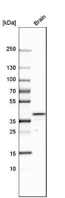 Western Blot: Heparan Sulfate 3-O-Sulfotransferase 1/HS3ST1 Antibody [NBP1-89375] - Analysis in human brain tissue.
