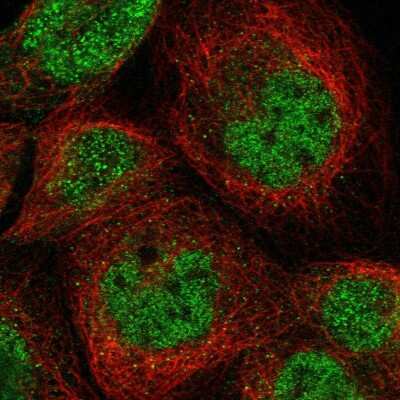 Immunocytochemistry/Immunofluorescence: Heparan Sulfate 6-O-Sulfotransferase 2/HS6ST2 Antibody [NBP1-90913] - Immunofluorescent staining of human cell line A-431 shows localization to nucleoplasm.