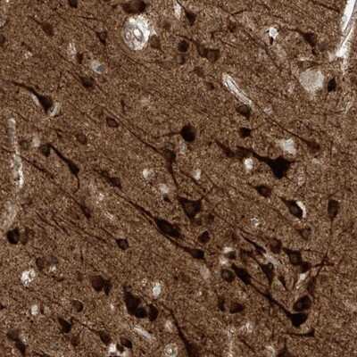 Immunohistochemistry-Paraffin: Heparan Sulfate 6-O-Sulfotransferase 2/HS6ST2 Antibody [NBP1-90913] - Staining of human cerebral cortex shows strong cytoplasmic positivity in neuronal cells.