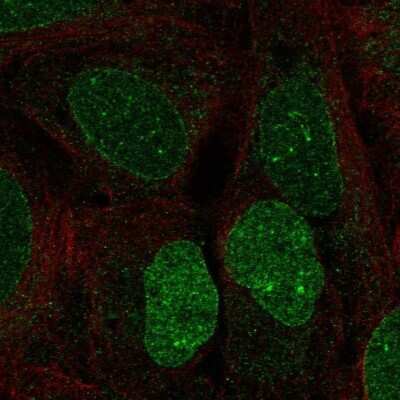 Immunocytochemistry/Immunofluorescence: Heparan Sulfate 6-O-Sulfotransferase 3/HS6ST3 Antibody [NBP2-69063] - Staining of human cell line U-2 OS shows localization to nucleoplasm & nuclear membrane. Antibody staining is shown in green.