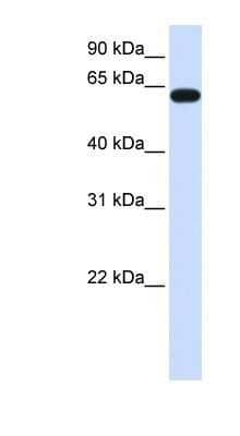 Western Blot: Heparan Sulfate 6-O-Sulfotransferase 3/HS6ST3 Antibody [NBP1-91328] - Human Brain lysate, concentration 0.2-1 ug/ml.