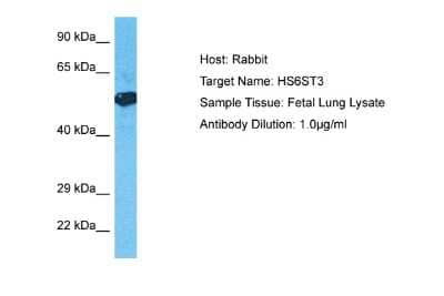 Western Blot: Heparan Sulfate 6-O-Sulfotransferase 3/HS6ST3 Antibody [NBP2-87562] - Host: Rabbit. Target Name: H6ST3. Sample Type: Fetal Lung lysates. Antibody Dilution: 1.0ug/ml