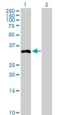Western Blot: Hepassocin/FGL1 Antibody [H00002267-D01P] - Analysis of FGL1 expression in transfected 293T cell line by FGL1 polyclonal antibody.Lane 1: FGL1 transfected lysate(36.40 KDa).Lane 2: Non-transfected lysate.