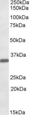 Western Blot: Hepassocin/FGL1 Antibody [NBP1-45216] - Analysis of  human Liver lysate (35ug protein in RIPA buffer) using NBP1-45216 at 0.1ug/ml. Primary incubation was 1 hour. Detected by chemiluminescence.