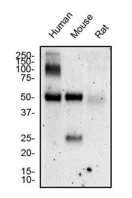 Western Blot: Hepatic Sinusoidal Endothelial Cells Antibody (SE-1) - Azide and BSA Free [NBP2-80759] - Total protein from human, mouse and rat liver was separated on a 12% gel by SDS-PAGE, transferred to PVDF membrane and blocked in 5% non-fat milk in TBST. The membrane was probed with 2.0 ug/ml anti-H.S.E.C in 1% non-fat milk in TBST and detected with an anti-mouse HRP secondary antibody using chemiluminescence. Image from the standard format of this antibody.