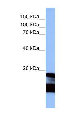 Western Blot: Hepatitis B Antigen Antibody (4H9) [NBP1-79176] - Titration: 1.0ug/ml Positive Control: HBVgp3 X protein.