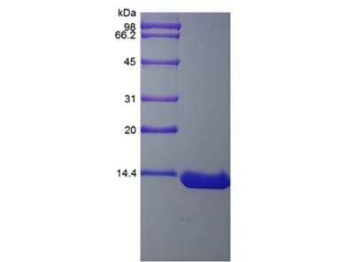 SDS-Page: Hepatitis B preS1 Protein [NBP2-35890]