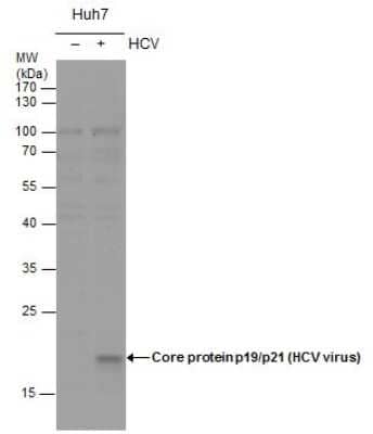 Western Blot Hepatitis C Virus Core Antigen Antibody - BSA Free