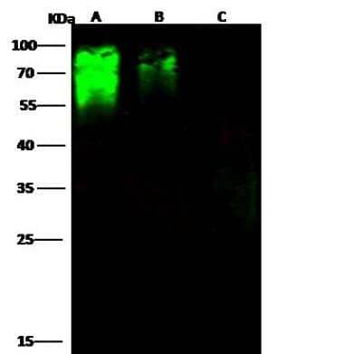 Western Blot Hepatitis C Virus E2 Antibody