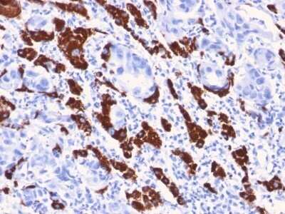 Immunohistochemistry-Paraffin: Hepatocyte Specific Antigen Antibody (OCH1E5) - Azide and BSA Free [NBP2-34699] - Formalin-fixed, paraffin-embedded human Liver stained with Hepatocyte Specific Antigen Antibody (OCH1E5).