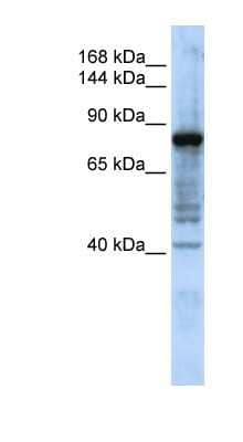 Western Blot: Hephaestin Antibody [NBP1-62496] - Titration: 0.2-1 ug/ml, Positive Control: MCF7 cell lysate.