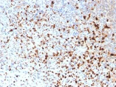 Immunohistochemistry-Paraffin: Herpes Simplex Virus 1 Antibody (10A3) - Azide and BSA Free [NBP3-08625] - Formalin-fixed, paraffin-embedded human Cervix stained with Herpes Simplex Virus 1 Mouse Monoclonal Antibody (10A3).