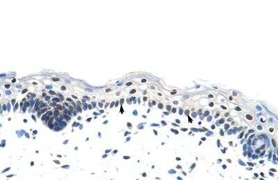 Immunohistochemistry-Paraffin: Heterogeneous Nuclear Ribonucleoprotein (A1-like) Antibody [NBP1-80446] - Human Skin Tissue Squamous epithelial cells (Indicated with Arrows), 4-8ug/ml.