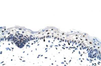 Immunohistochemistry-Paraffin: Heterogeneous Nuclear Ribonucleoprotein (A1-like) Antibody [NBP1-80446] - Rabbit Anti-RP11-78J21.1 Antibody. Paraffin Embedded Tissue: Human Skin. Cellular Data: Epidermal cells. Antibody Concentration: 4.0-8.0 ug/ml. Magnification: 400X