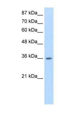 Western Blot: Heterogeneous Nuclear Ribonucleoprotein (A1-like) Antibody [NBP1-80446] - Jurkat cell lysate, Antibody Titration: 0.2-1 ug/ml