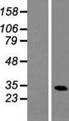 Western Blot: Heterogeneous Nuclear Ribonucleoprotein (A1-like) Overexpression Lysate (Adult Normal) [NBP2-11004] Left-Empty vector transfected control cell lysate (HEK293 cell lysate); Right -Over-expression Lysate for Heterogeneous Nuclear Ribonucleoprotein (A1-like).