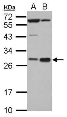 Western Blot: Hex Antibody [NBP2-16811] - Sample (30 ug of whole cell lysate) A: K562 B: THP-1 12% SDS PAGE gel, diluted at 1:5000.