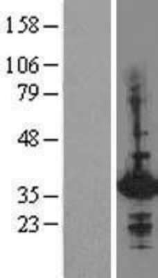 Western Blot: Hex Overexpression Lysate (Adult Normal) [NBL1-11531] Left-Empty vector transfected control cell lysate (HEK293 cell lysate); Right -Over-expression Lysate for Hex.