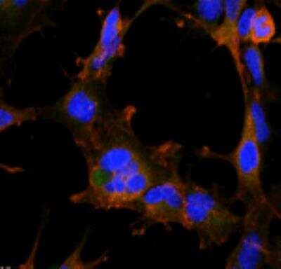 Immunocytochemistry/ Immunofluorescence Hexanoyl-Lysine adduct Antibody (5D9) - BSA Free
