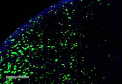 Immunohistochemistry Hexanoyl-Lysine adduct Antibody (5D9) - BSA Free