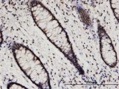 Immunohistochemistry-Paraffin: Hexim 1 Antibody (2D12) [H00010614-M02] - Analysis of monoclonal antibody to HEXIM1 on formalin-fixed paraffin-embedded human colon. Antibody concentration 3 ug/ml.