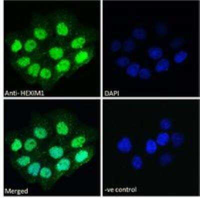 Immunocytochemistry/Immunofluorescence: Hexim 1 Antibody [NB100-55391] - Immunofluorescence analysis of paraformaldehyde fixed A431 cells, permeabilized with 0.15% Triton. Primary incubation 1hr (10 ug/mL) followed by Alexa Fluor 488 secondary antibody (2 ug/mL), showing nuclear staining. The nuclear stain is DAPI (blue). Negative control: Unimmunized goat IgG (10 ug/mL) followed by Alexa Fluor 488 secondary antibody (2 ug/mL).