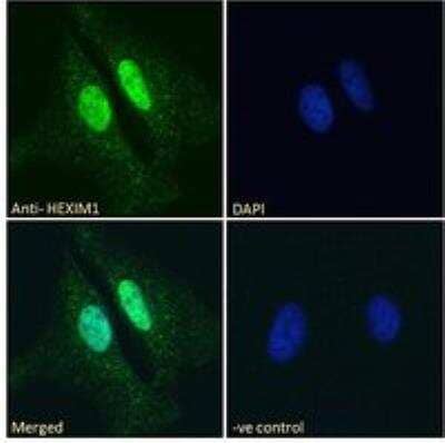 Immunocytochemistry/Immunofluorescence: Hexim 1 Antibody [NB100-55391] - Immunofluorescence analysis of paraformaldehyde fixed HeLa cells, permeabilized with 0.15% Triton. Primary incubation 1hr (10 ug/mL) followed by Alexa Fluor 488 secondary antibody (2 ug/mL), showing nuclear staining. The nuclear stain is DAPI (blue). Negative control: Unimmunized goat IgG (10 ug/mL) followed by Alexa Fluor 488 secondary antibody (2 ug/mL).