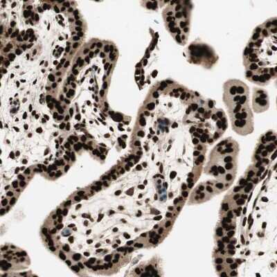 Immunohistochemistry-Paraffin: Hexim 1 Antibody [NBP1-85559] - Staining of human placenta shows strong nuclear positivity in trophoblastic cells.