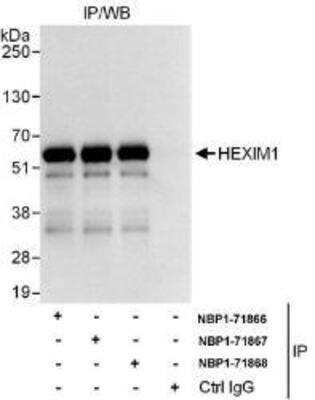 Immunoprecipitation: Hexim 1 Antibody [NBP1-71866] - Whole cell lysate (1 mg for IP, used for IP at 6 mcg/mg lysate.  HEXIM1 was also immunoprecipitated by rabbit anti-HEXIM1 antibodies NBP1-71867 and NBP1-71868, which recognize downstream epitopes.