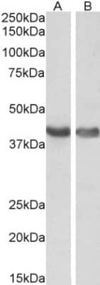 Western Blot: Hexim 1 Antibody [NB100-55391] - Staining of human (A) and mouse (B) heart lysates (35 ug protein in RIPA buffer). Antibody at 0.1 ug/mL. Primary incubation was 1 hour. Detected by chemiluminescence.