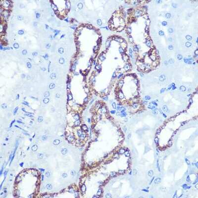 Immunohistochemistry-Paraffin: Hexokinase 1 Antibody (6B7Q2) [NBP3-15274] - Immunohistochemistry of paraffin-embedded rat kidney using Hexokinase 1 Rabbit mAb (NBP3-15274) at dilution of 1:100 (40x lens).Perform microwave antigen retrieval with 10 mM PBS buffer pH 7.2 before commencing with IHC staining protocol.