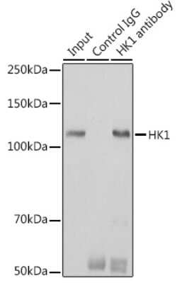 Immunoprecipitation: Hexokinase 1 Antibody (6B7Q2) [NBP3-15274] - Immunoprecipitation analysis of 600ug extracts of Mouse brain cells using 3ug Hexokinase 1 antibody (NBP3-15274). Western blot was performed from the immunoprecipitate using Hexokinase 1 (NBP3-15274) at a dilition of 1:1000.