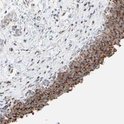 <b>Independent Antibodies Validation. </b>Immunohistochemistry-Paraffin: Hexokinase 1 Antibody [NBP1-87480] - Staining of human urinary bladder shows strong cytoplasmic positivity in urothelial cells.