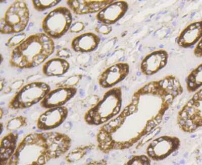 Immunohistochemistry-Paraffin: Hexokinase 1 Antibody (ST47-05) [NBP2-67503] - Analysis of paraffin-embedded human kidney tissue using anti-Hexokinase 1 antibody. Counter stained with hematoxylin.