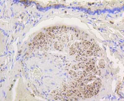 Immunohistochemistry-Paraffin: Hexokinase 1 Antibody (ST47-05) [NBP2-67503] - Analysis of paraffin-embedded human lung tissue using anti-Hexokinase 1 antibody. Counter stained with hematoxylin.