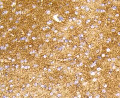 Immunohistochemistry-Paraffin: Hexokinase 1 Antibody (ST47-05) [NBP2-67503] - Analysis of paraffin-embedded mouse brain tissue using anti-Hexokinase 1 antibody. Counter stained with hematoxylin.